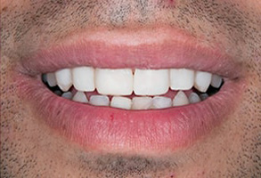 dental images 10016
