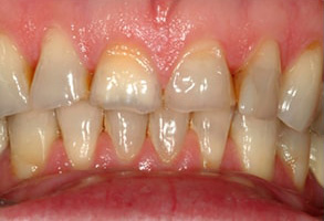 Murray Hill Dental Images
