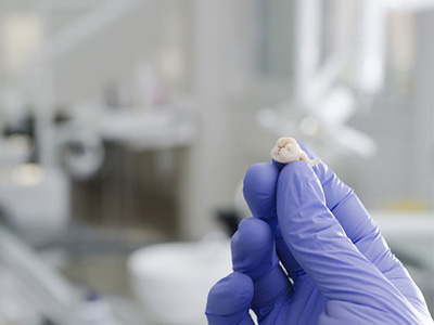 The image shows a person s hand holding a tooth with a blue glove on, suggesting a dental or medical setting.