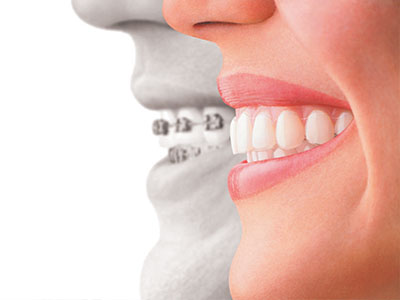 The image features a composite of a human face with a dental implant on the upper right side, superimposed over an image of a smiling mouth.