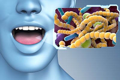 The image shows a 3D rendering of a human face with an open mouth, displaying a yellowish substance resembling bacteria or germs, with a microscopic view of these cells on the right side, indicating a focus on healthcare or medical education, possibly related to oral health or bacterial infections.