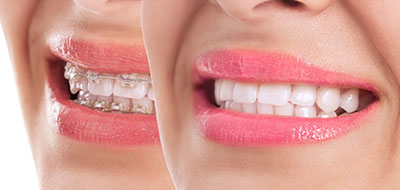 The image displays a close-up of a person s smiling face with a focus on their teeth and lips, which are enhanced by makeup.