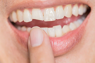 The image shows a close-up of a person s smiling face with teeth, holding their finger near their mouth, possibly indicating a moment of surprise or discovery.