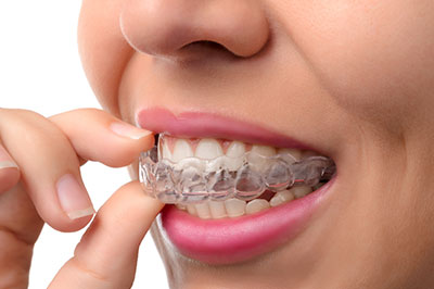 The image shows a person with a full set of braces, examining their teeth while holding a toothpick near their mouth.