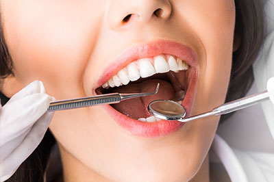 A woman with her mouth open wide, showing teeth, while holding a dental instrument near her mouth.