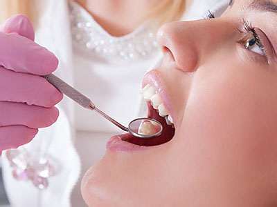 A dental hygienist using an instrument to clean a patient s teeth during a dental appointment.