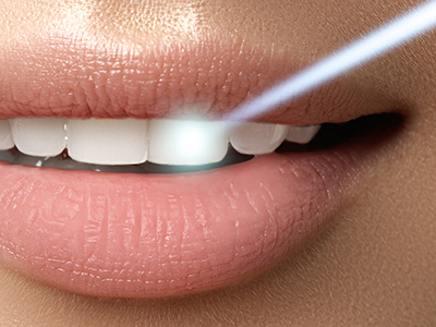 The image features a close-up view of a woman s face with her lips slightly parted, showcasing a product with a blue light emanating from it, which appears to be an LED device, possibly for skincare or dental care, placed near her mouth.